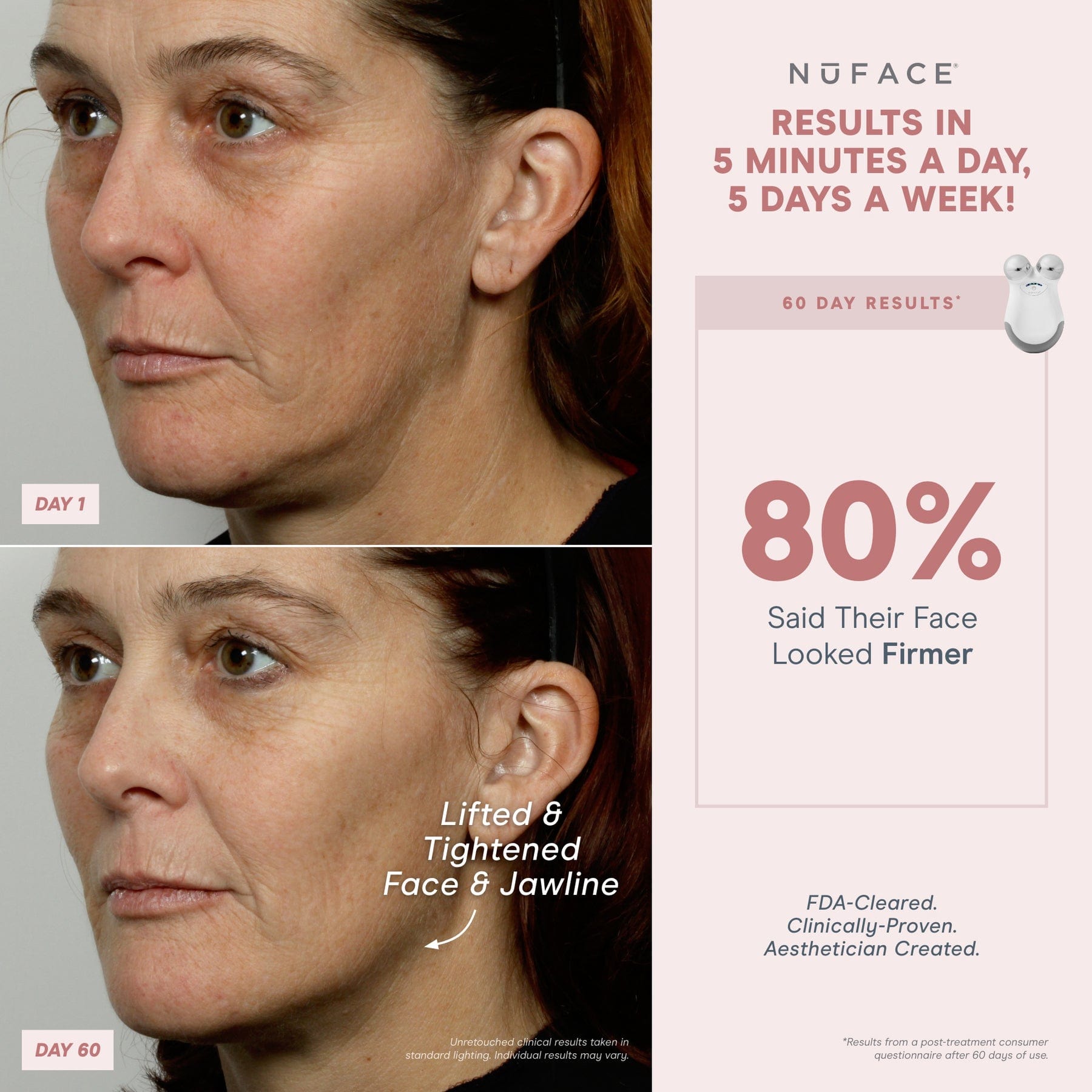 Refreshed NuFACE® Mini Starter Kit - Mini Facial Toning Device